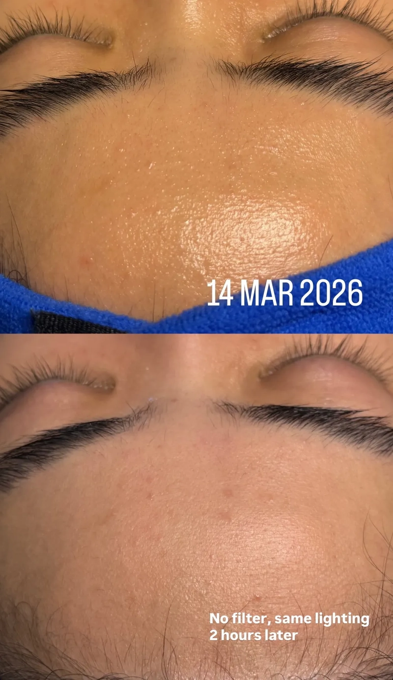 Skin bumps, dullness