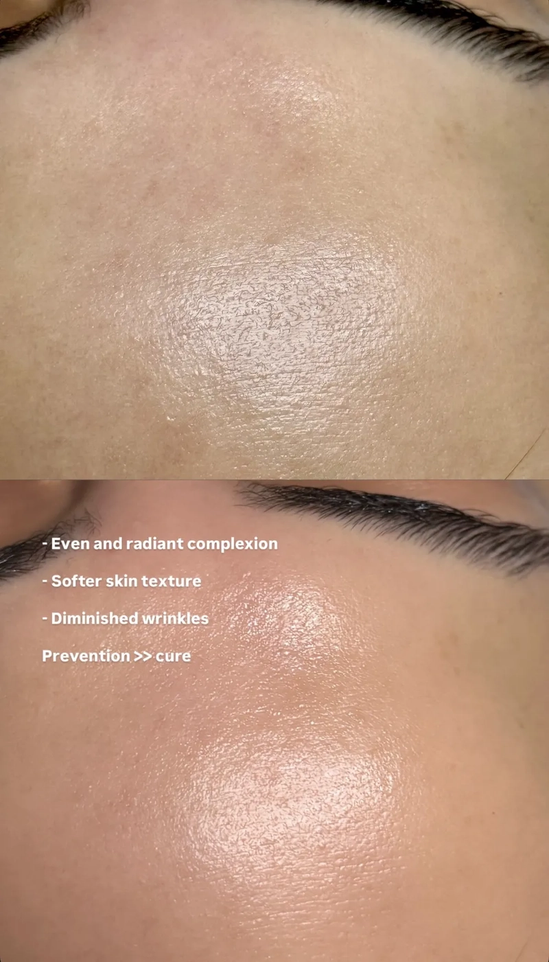 Softer skin texture