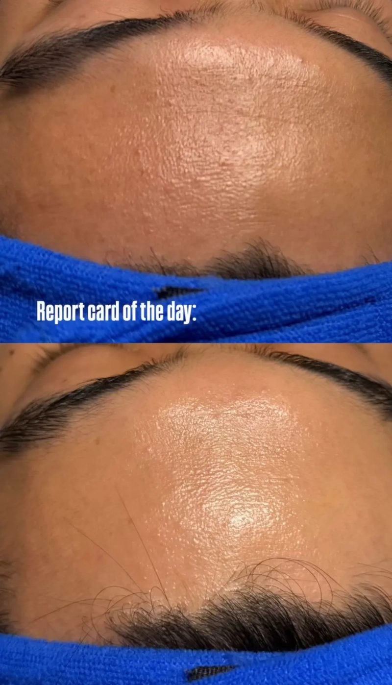 Dry skin, dullness
