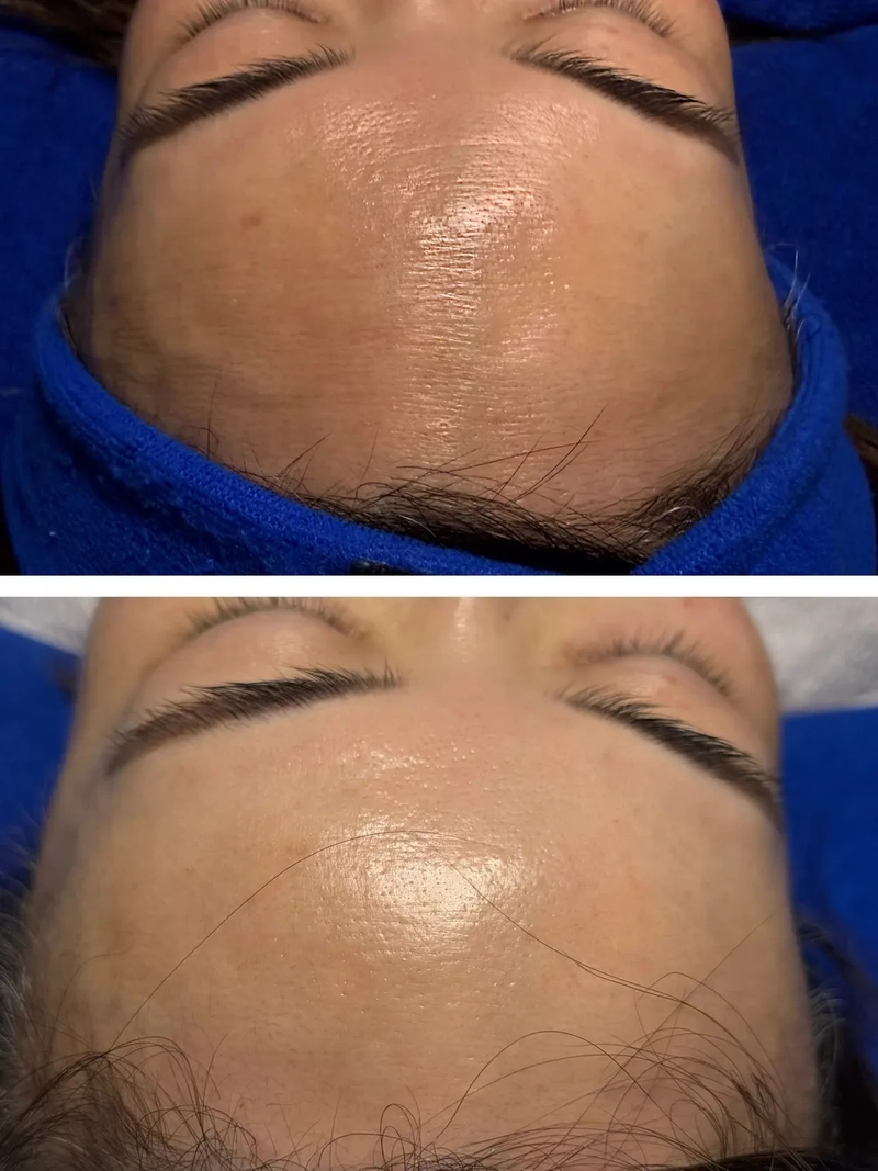 Aged, dry skin
