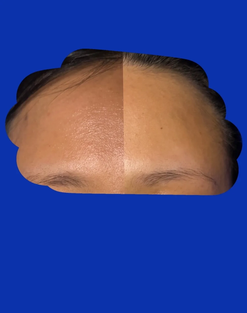 Dry, sensitive skin