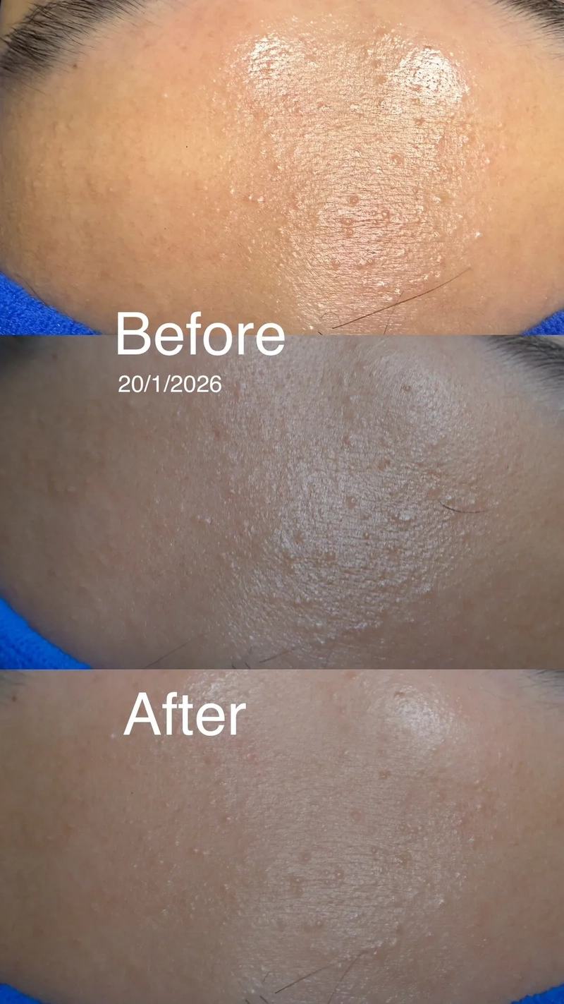 Skin bumps, sensitive skin